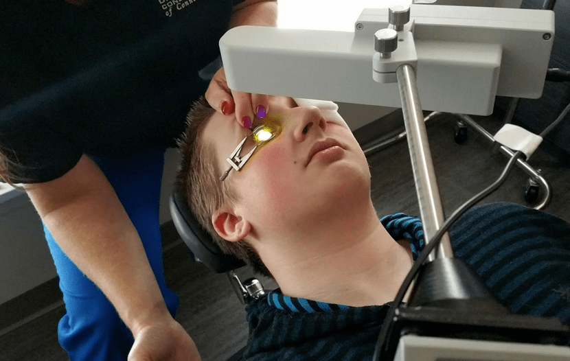 A reticulación elimina efectivamente a Keratoconus ao comezo do seu desenvolvemento